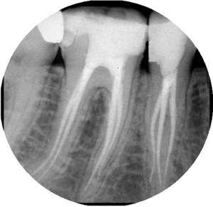 endodonzia